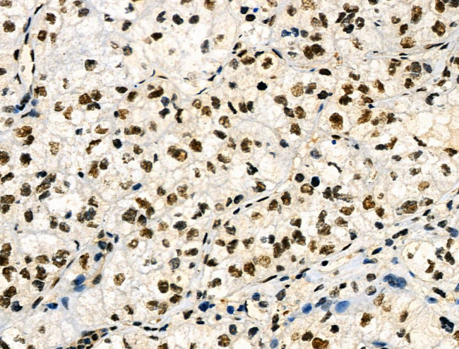 Phospho-p130 (Thr642) Antibody in Immunohistochemistry (Paraffin) (IHC (P))