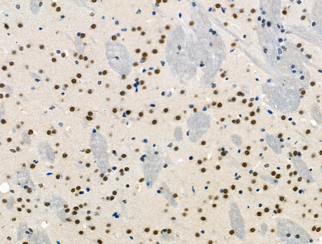 Phospho-p130 (Thr642) Antibody in Immunohistochemistry (Paraffin) (IHC (P))