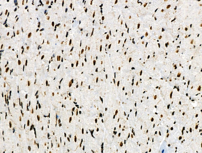 Phospho-p130 (Thr642) Antibody in Immunohistochemistry (Paraffin) (IHC (P))