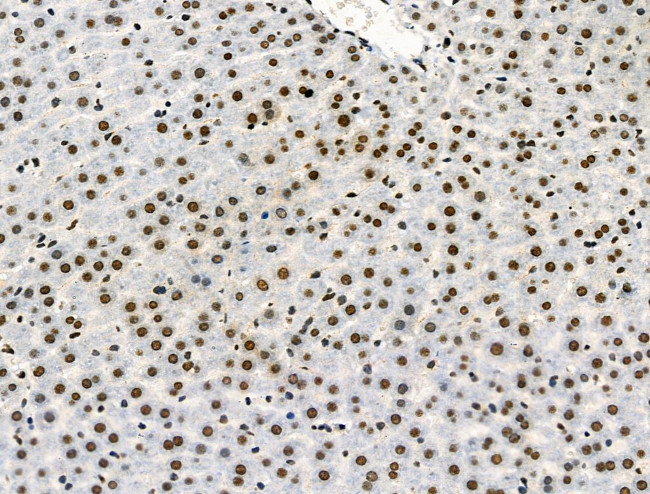 Phospho-p130 (Thr642) Antibody in Immunohistochemistry (Paraffin) (IHC (P))