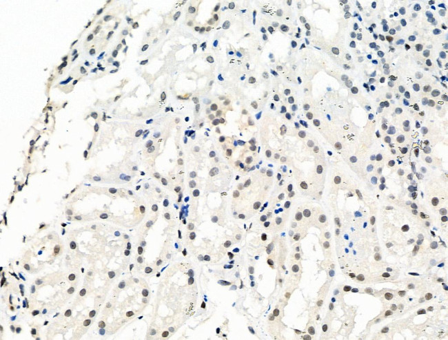 Phospho-Bcl-3 (Ser402) Antibody in Immunohistochemistry (Paraffin) (IHC (P))