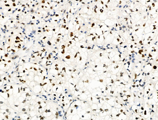 Phospho-Bcl-3 (Ser402) Antibody in Immunohistochemistry (Paraffin) (IHC (P))