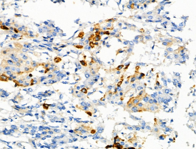 Phospho-C5AR1 (Ser327) Antibody in Immunohistochemistry (Paraffin) (IHC (P))