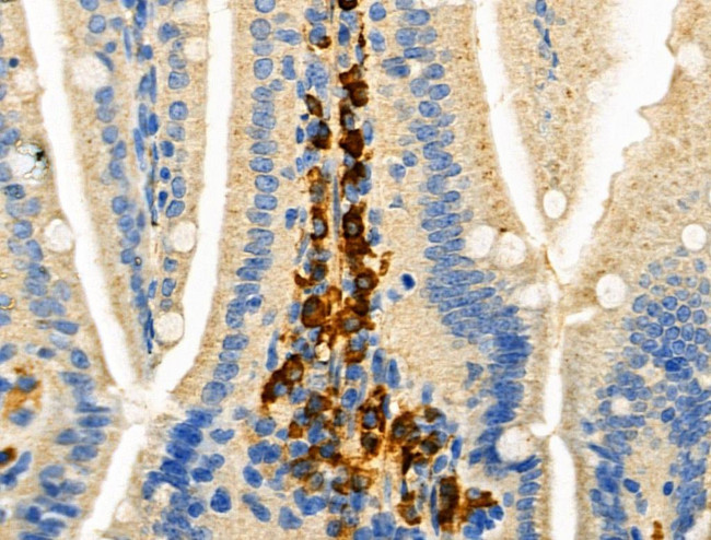 Phospho-C5AR1 (Ser327) Antibody in Immunohistochemistry (Paraffin) (IHC (P))