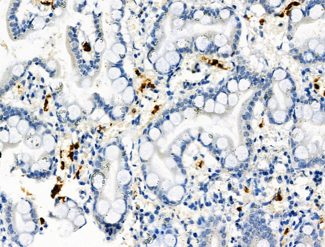 Phospho-RRAS (Tyr66) Antibody in Immunohistochemistry (Paraffin) (IHC (P))