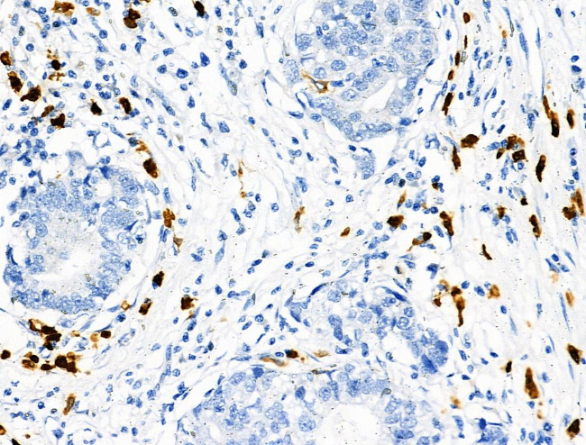 Phospho-RRAS (Tyr66) Antibody in Immunohistochemistry (Paraffin) (IHC (P))