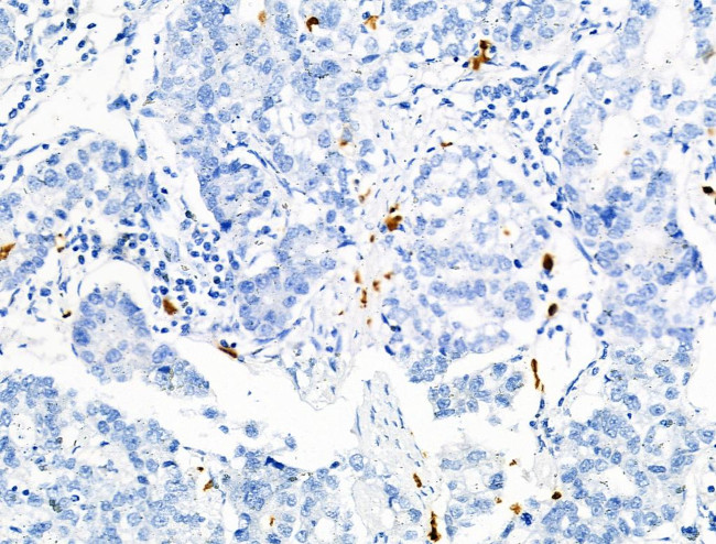 Phospho-RRAS (Tyr66) Antibody in Immunohistochemistry (Paraffin) (IHC (P))