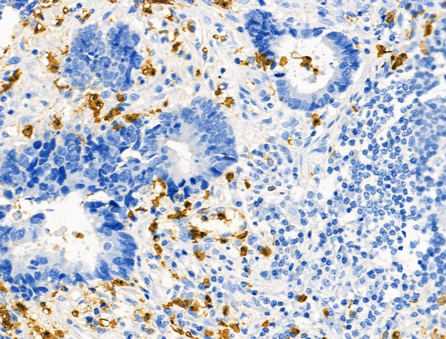 Phospho-RRAS (Tyr66) Antibody in Immunohistochemistry (Paraffin) (IHC (P))