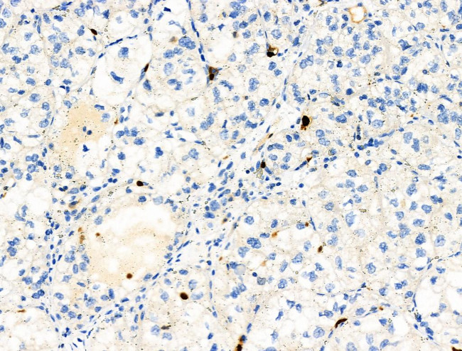 Phospho-RRAS (Tyr66) Antibody in Immunohistochemistry (Paraffin) (IHC (P))