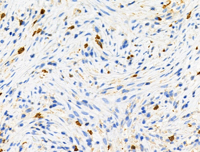 Phospho-RRAS (Tyr66) Antibody in Immunohistochemistry (Paraffin) (IHC (P))