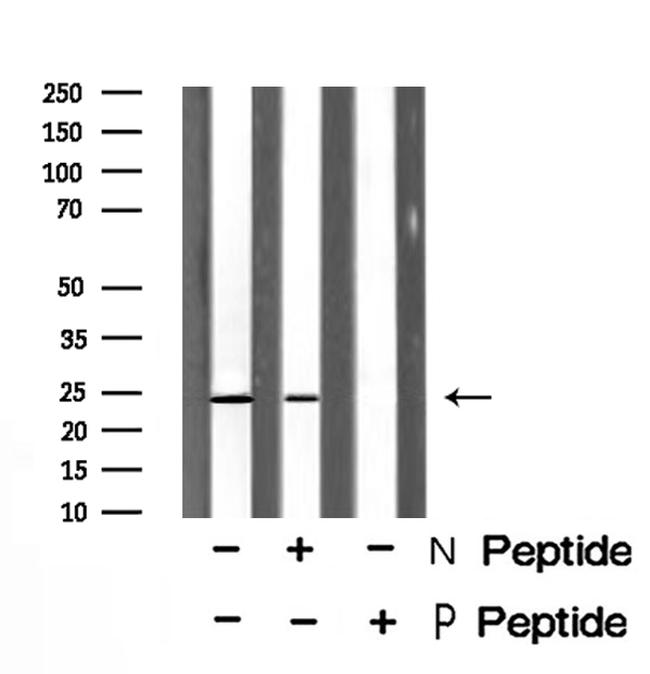 Phospho-RRAS (Tyr66) Antibody in Western Blot (WB)