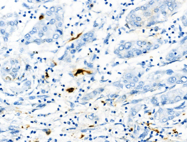 Phospho-S100A9 (Thr113) Antibody in Immunohistochemistry (Paraffin) (IHC (P))