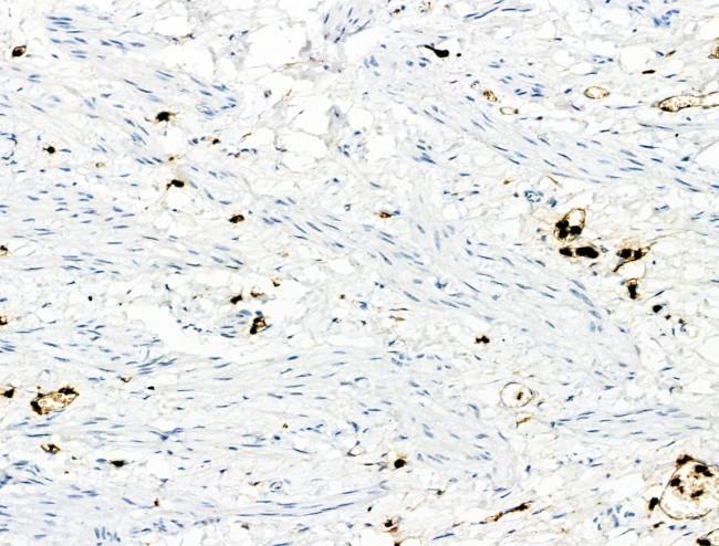 Phospho-S100A9 (Thr113) Antibody in Immunohistochemistry (Paraffin) (IHC (P))