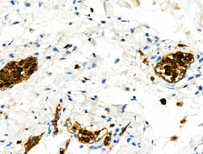 Phospho-S100A9 (Thr113) Antibody in Immunohistochemistry (Paraffin) (IHC (P))