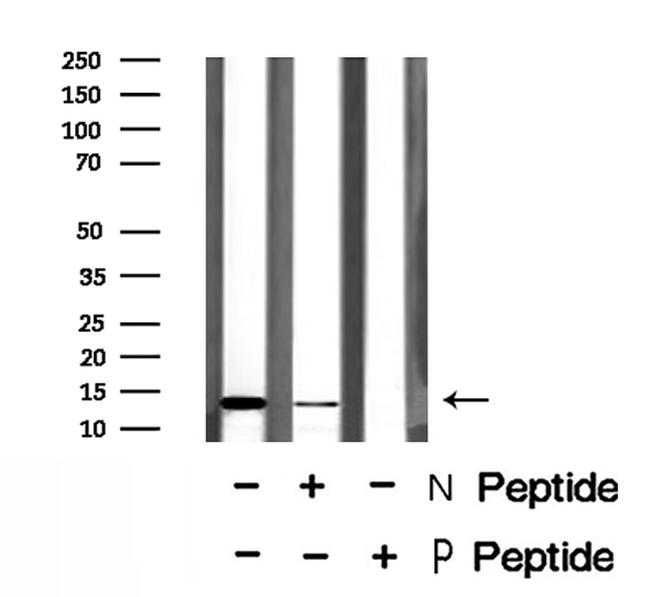 Phospho-S100A9 (Thr113) Antibody in Western Blot (WB)