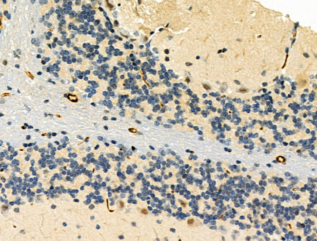 Phospho-TOP2A (Ser1337) Antibody in Immunohistochemistry (Paraffin) (IHC (P))