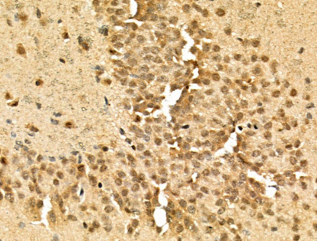 Phospho-TOP2A (Ser1337) Antibody in Immunohistochemistry (Paraffin) (IHC (P))