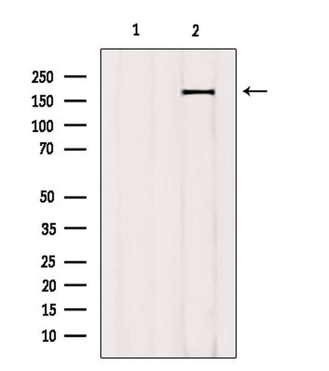 Phospho-TOP2A (Ser1337) Antibody in Western Blot (WB)