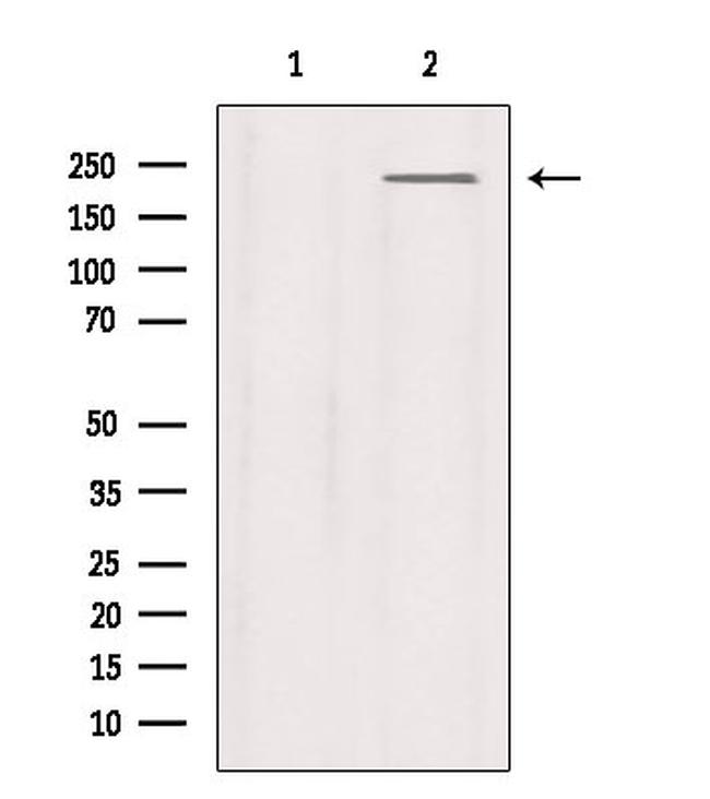 SCN9A Antibody in Western Blot (WB)