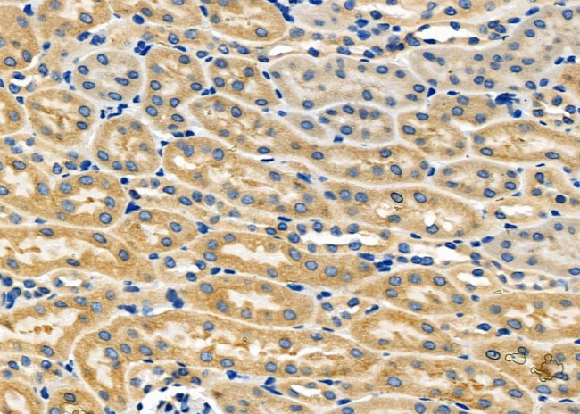 SFRP1 Antibody in Immunohistochemistry (Paraffin) (IHC (P))