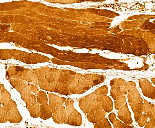 Myosin 4 Antibody in Immunohistochemistry (Paraffin) (IHC (P))