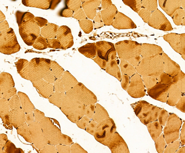 Myosin 4 Antibody in Immunohistochemistry (Paraffin) (IHC (P))