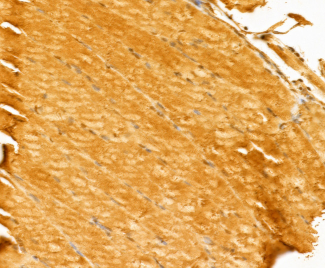 Myosin 4 Antibody in Immunohistochemistry (Paraffin) (IHC (P))