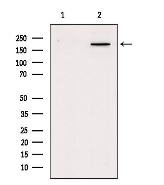 Myosin 4 Antibody in Western Blot (WB)