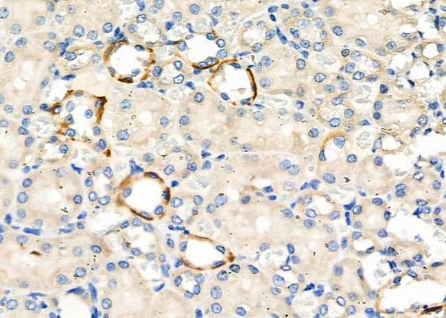 NKCC1 Antibody in Immunohistochemistry (Paraffin) (IHC (P))