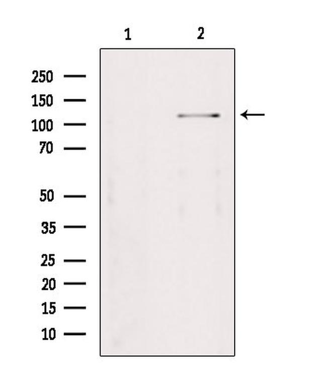 TAOK2 Antibody in Western Blot (WB)