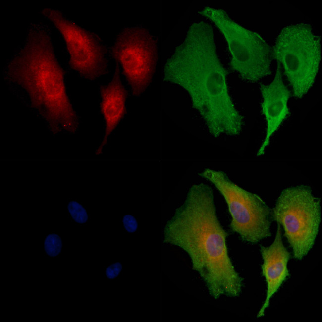 GPR30 Antibody in Immunocytochemistry (ICC/IF)