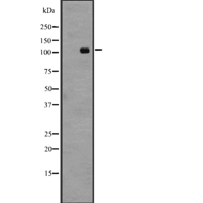 LGR4 Antibody in Western Blot (WB)