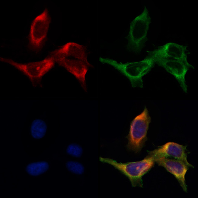 TROP2 Antibody in Immunocytochemistry (ICC/IF)