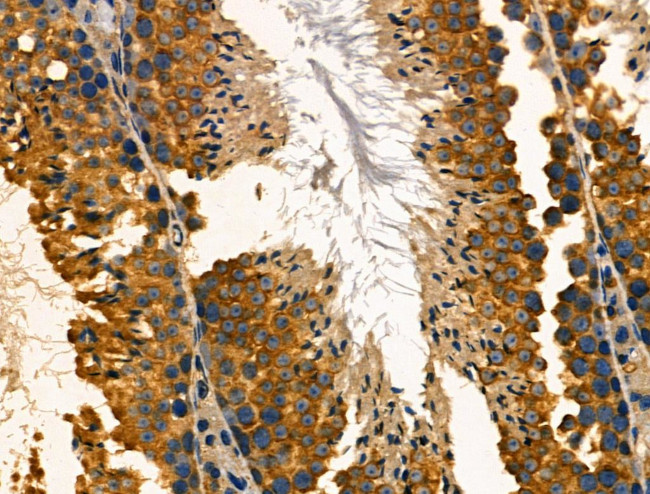 TROP2 Antibody in Immunohistochemistry (Paraffin) (IHC (P))