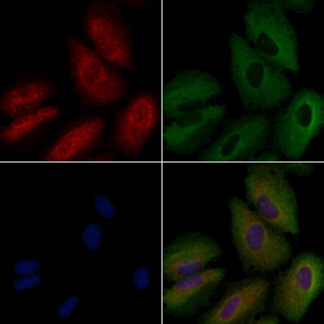 FGR Antibody in Immunocytochemistry (ICC/IF)