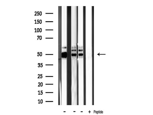 CKMT2 Antibody in Western Blot (WB)