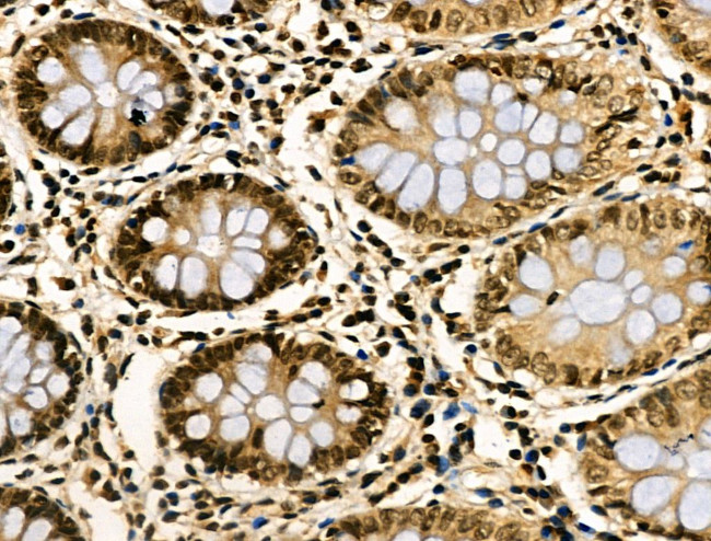 NFYA Antibody in Immunohistochemistry (Paraffin) (IHC (P))