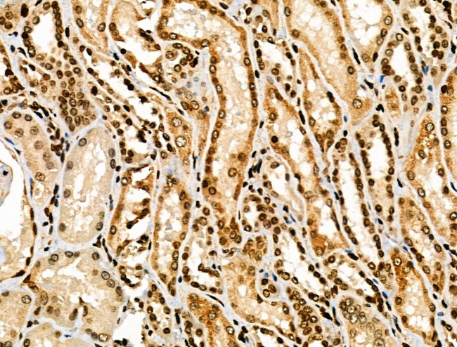 NFYA Antibody in Immunohistochemistry (Paraffin) (IHC (P))