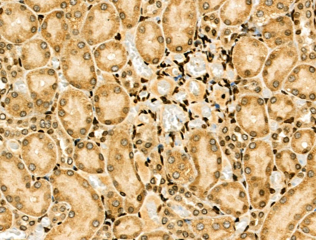 NFYA Antibody in Immunohistochemistry (Paraffin) (IHC (P))