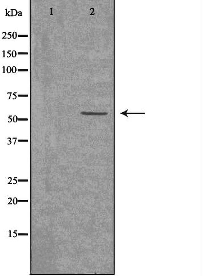 ACVRL1 Antibody in Western Blot (WB)