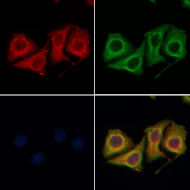 cGKII Antibody in Immunocytochemistry (ICC/IF)