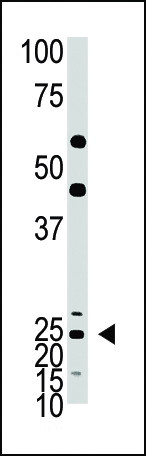 ASCL1 Antibody in Western Blot (WB)