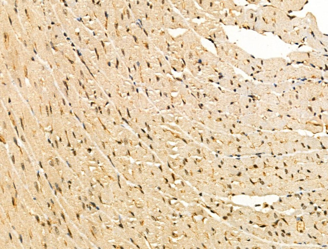 WTAP Antibody in Immunohistochemistry (Paraffin) (IHC (P))