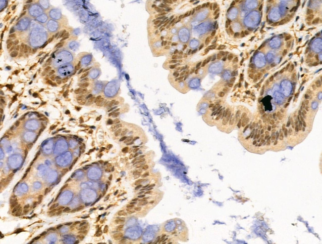 WTAP Antibody in Immunohistochemistry (Paraffin) (IHC (P))