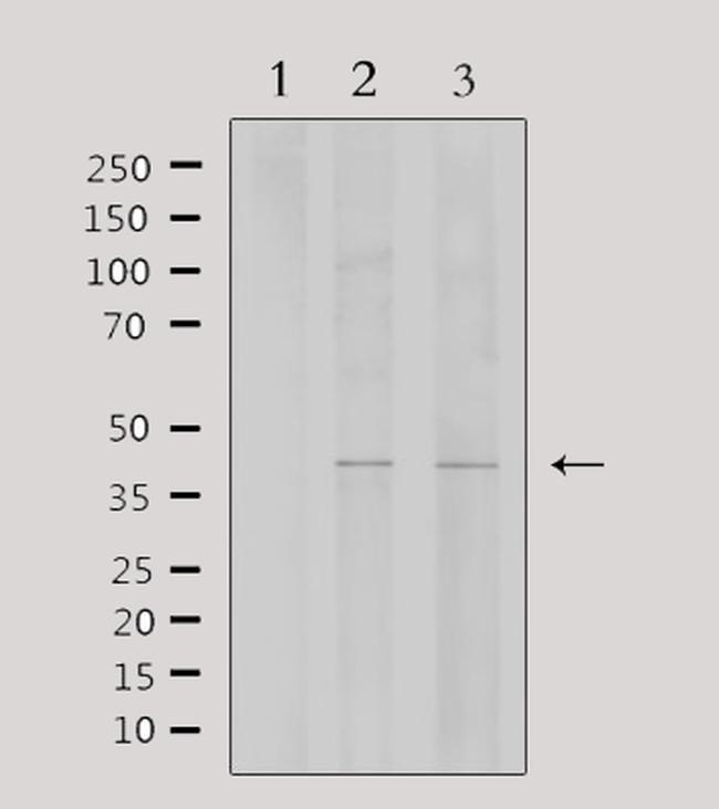 WTAP Antibody in Western Blot (WB)