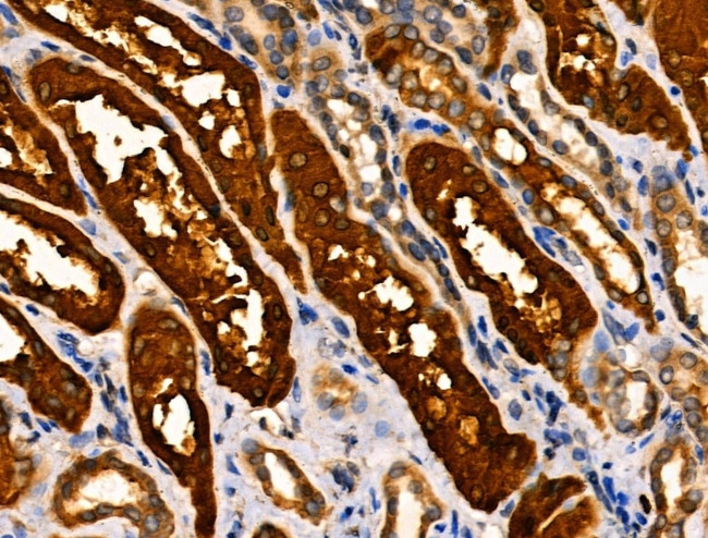 MKL1 Antibody in Immunohistochemistry (Paraffin) (IHC (P))