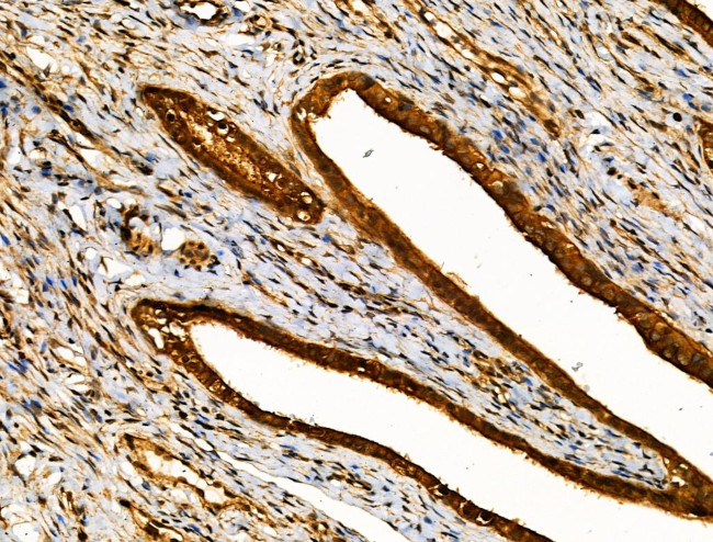 MKL1 Antibody in Immunohistochemistry (Paraffin) (IHC (P))