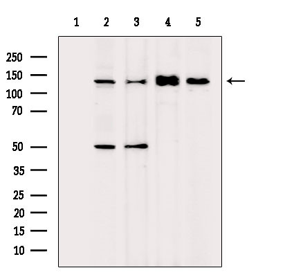 MKL1 Antibody in Western Blot (WB)