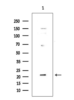 DUSP22 Antibody in Western Blot (WB)