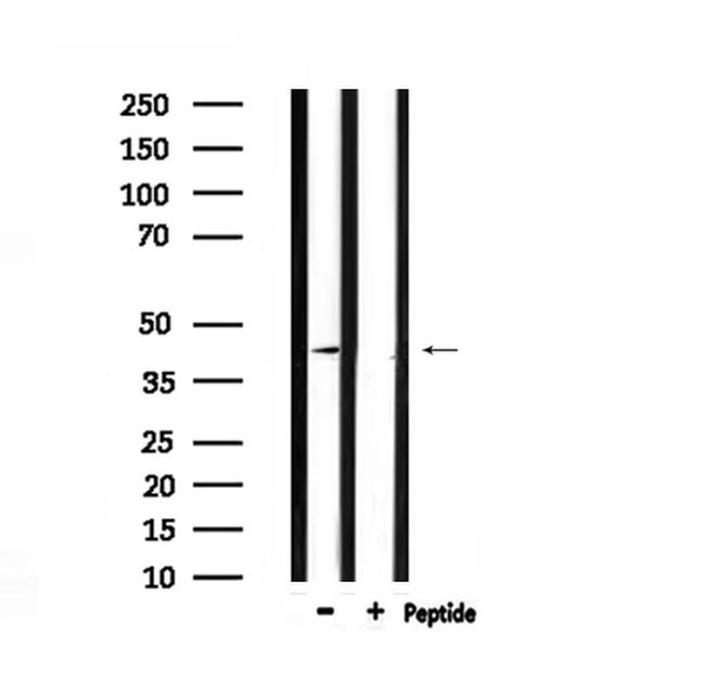 CMKLR1 Antibody in Western Blot (WB)